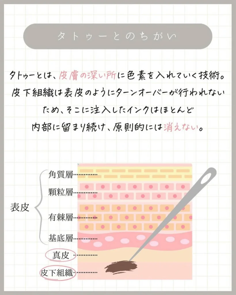 タトゥーとのちがい