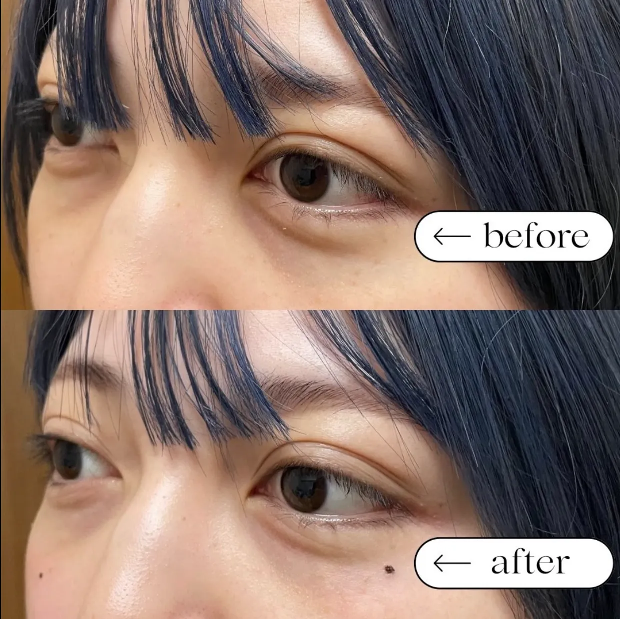 ホクロアートメイク